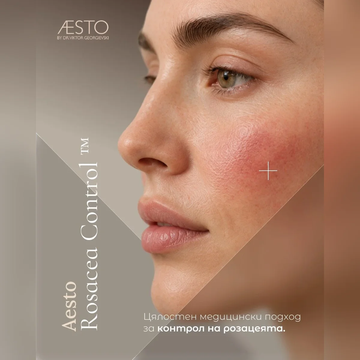 AESTO ROSACEA PROTOCOL™ — Control of redness and reactive skin